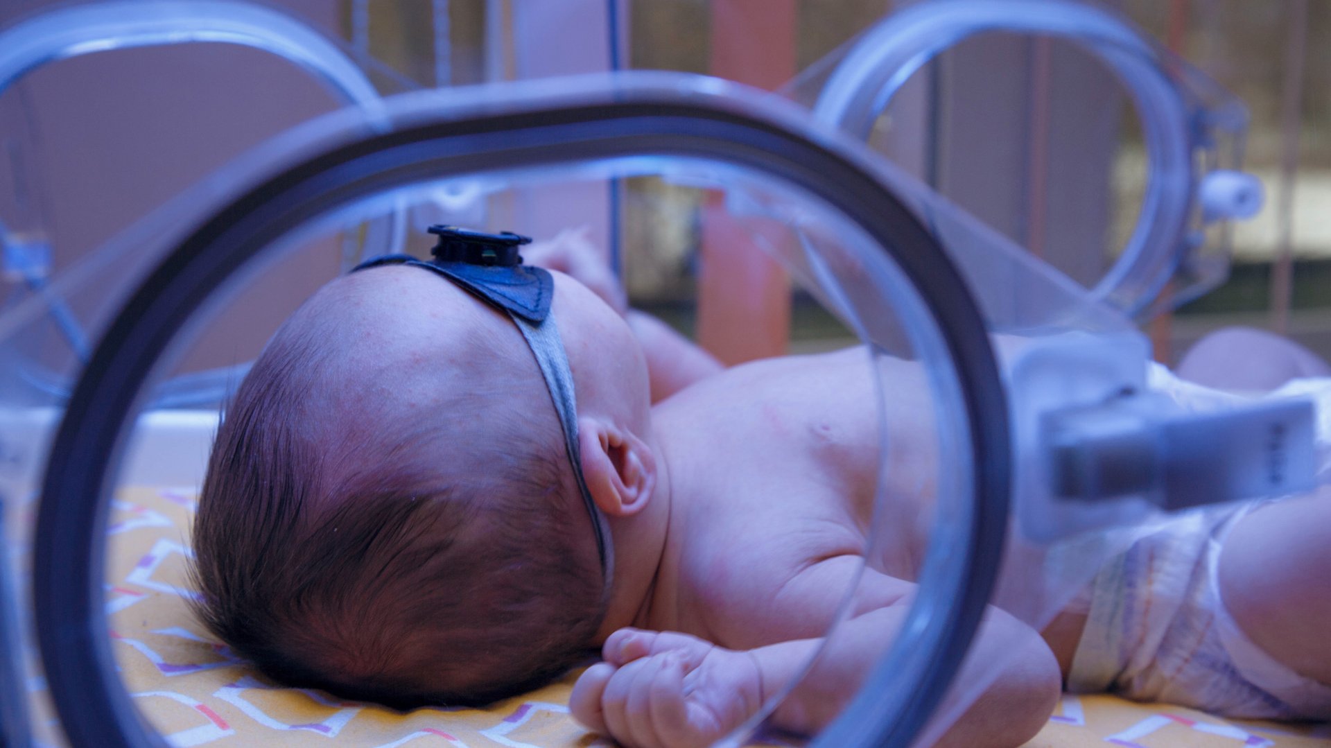 Dziecko naswietlane jest promieniami lezac w inkubatorze
